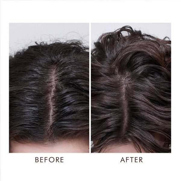 Moroccanoil Oily Scalp Treatment 45ml